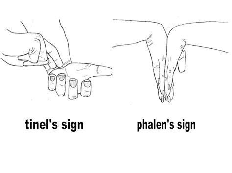 tinel's and phalen's sign